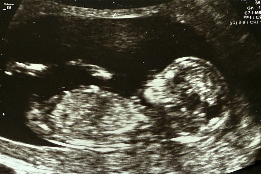 Spotlight on IVF regulation over embryo mix-up