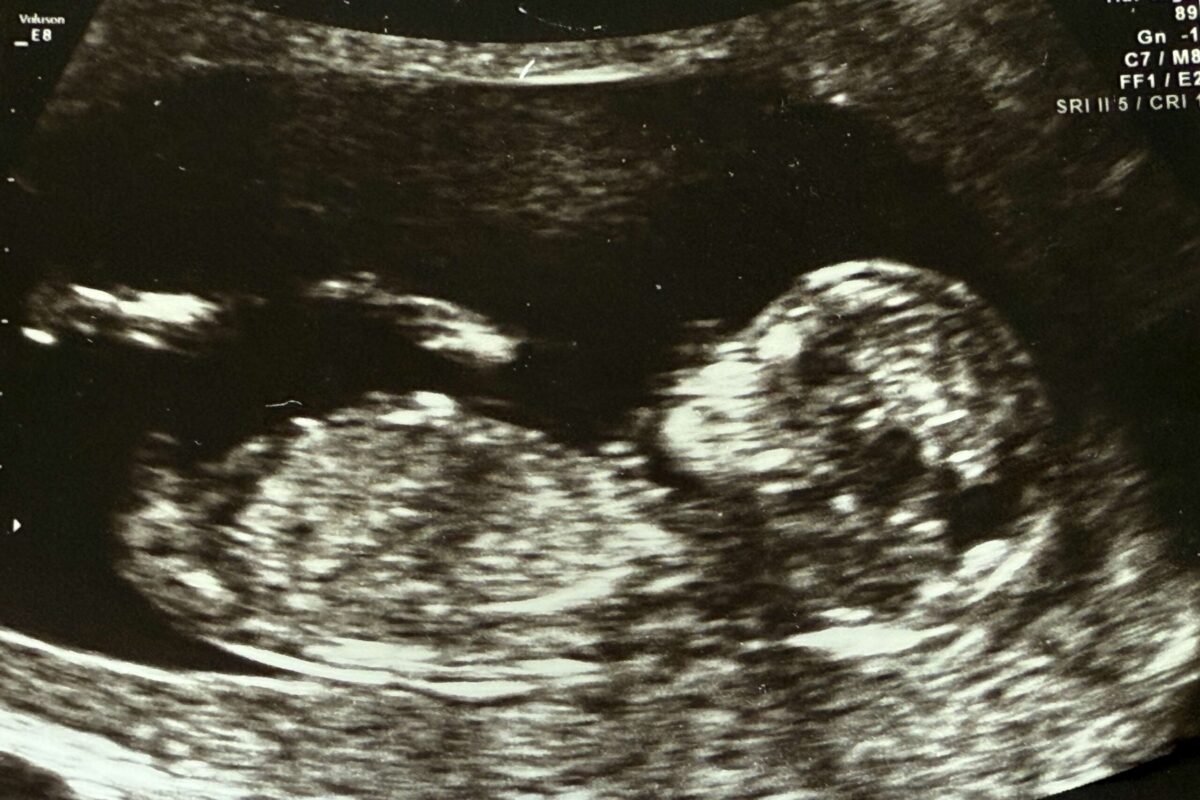 Stricter IVF regulation on cards as clinic boss quits