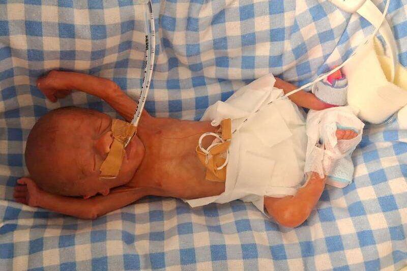 History-making miracle premmie continues to defy odds