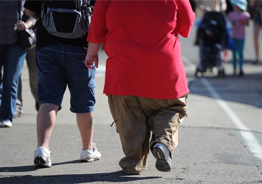 Growing obesity crisis tanking Aussie productivity