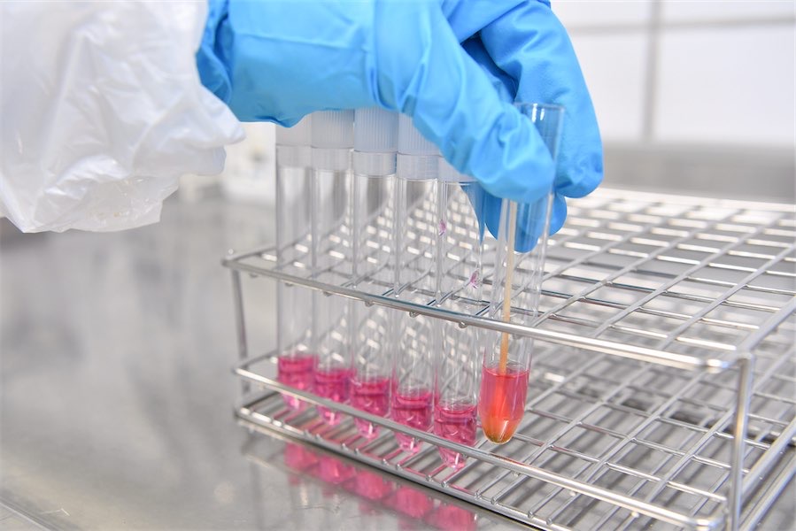 Deadly bird flu strain a ‘serious concern’ for wildlife
