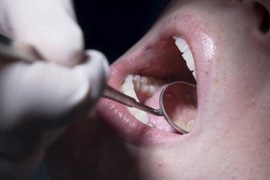 Young people brushing dental health aside, experts warn