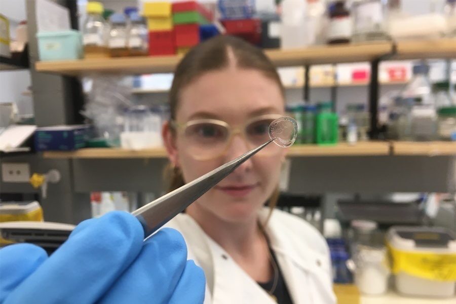 Synthetic bee silk set to take sting out of wounds
